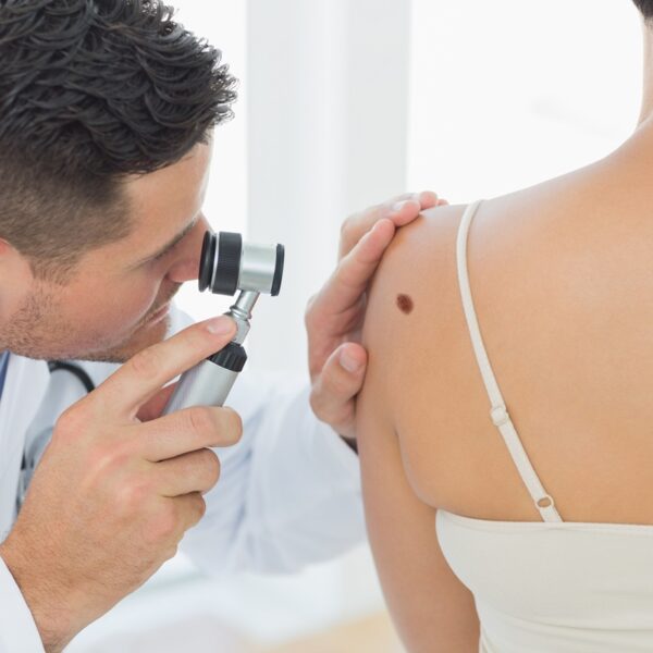 Dermatoskopia – na czym polega badanie znamion i kiedy warto je wykonać?
